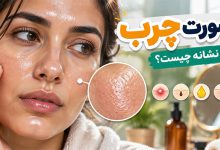 صورت چرب نشانه چیست؟ 7 عوارض پوست چرب (زن و مرد)